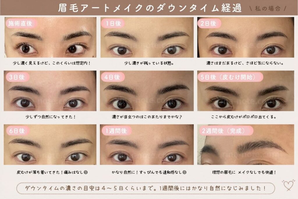 眉毛アートメイクのダウンタイム経過