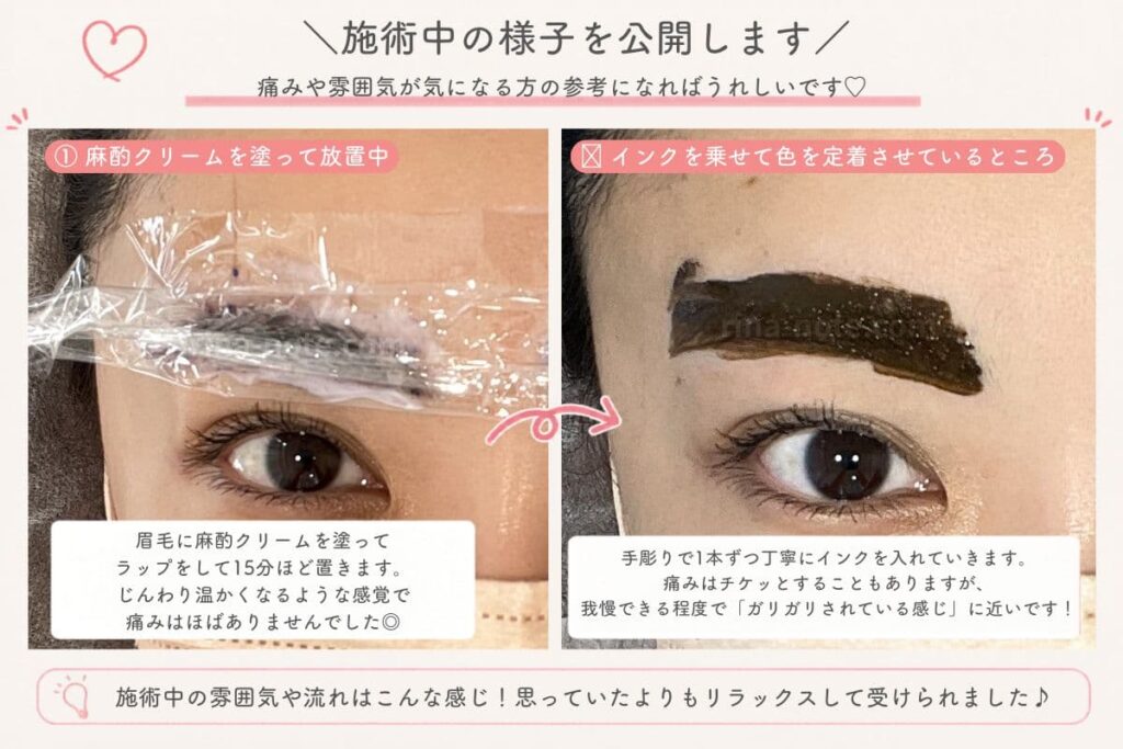 眉毛アートメイク施術中の様子