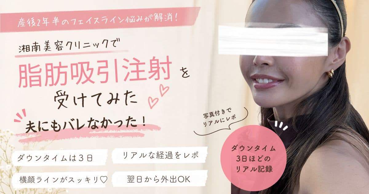 湘南美容クリニックで小顔脂肪吸引注射を受けた体験談