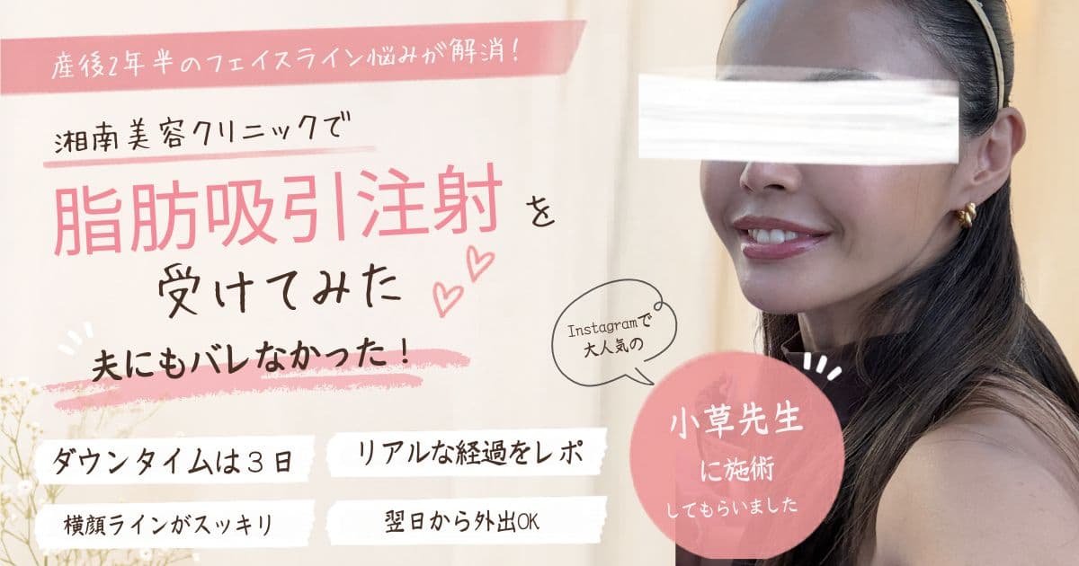 湘南美容クリニックで小顔脂肪吸引注射を受けた体験談